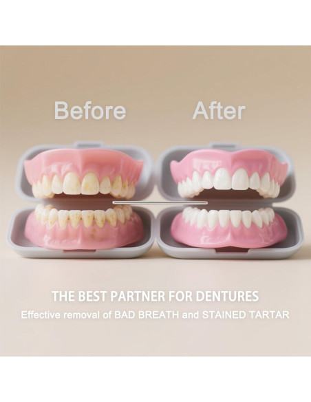 Tabletas de Limpieza Sifuland para Dentaduras y Retenedores - 30 Unidades