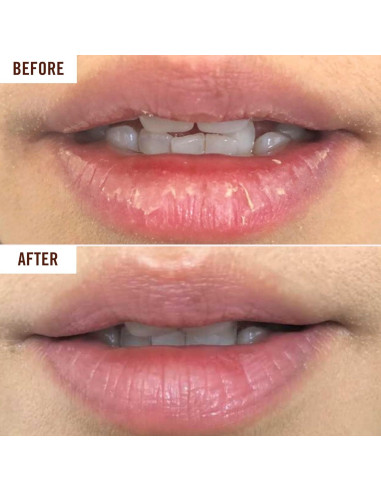 Bálsamo Labial Hidratante Hanalei 15g - Aceite de Kukui