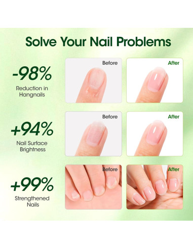 Aceite de Cutícula Gellen 10ml para Crecimiento y Reparación