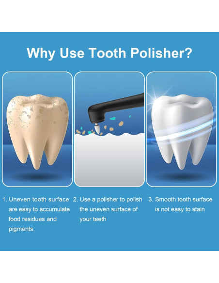 Pulidor de Dientes Eléctrico SIQUER con 5 Cabezas y Luz LED