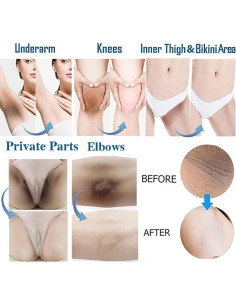 Crema Aclarante Gukei 31.4 ml para Áreas Íntimas y Axilas 2