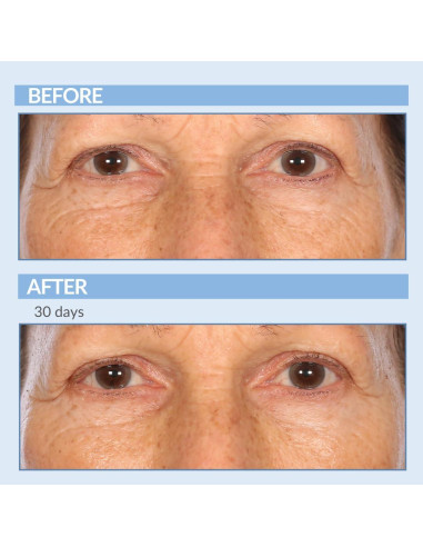 Set Cuidado Piel Anti-Envejecimiento Retinol Celmark 3 Piezas