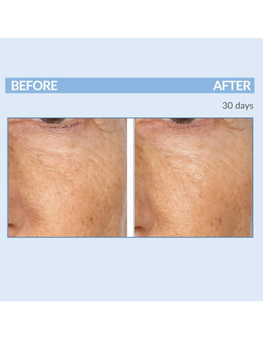 Set Cuidado Piel Anti-Envejecimiento Retinol Celmark 3 Piezas