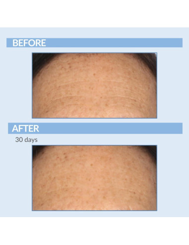 Set Cuidado Piel Anti-Envejecimiento Retinol Celmark 3 Piezas