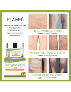 Crema para Venas Varicosas Resdam 2 PCS - Alivio y Reducción 2