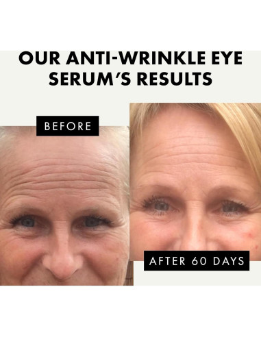 Suero para Ojos Eclat Skincare con Ácido Hialurónico 14.79 ml