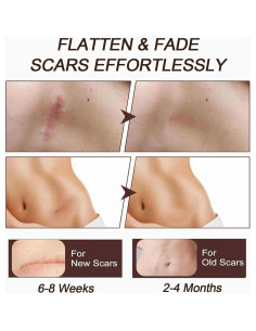 Bastón de Silicona para Cicatrices Genérico 9x3.6cm 17.8g 2