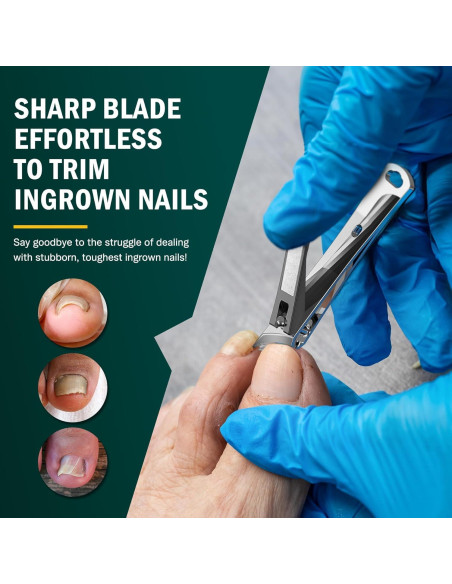 Cortauñas Curvado FVION para Uñas Encarnadas - Negro