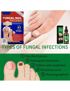 Parche Hidrogel para Uñas Fungosas Jynbloge - 21 Parches + Suero 30ml 2