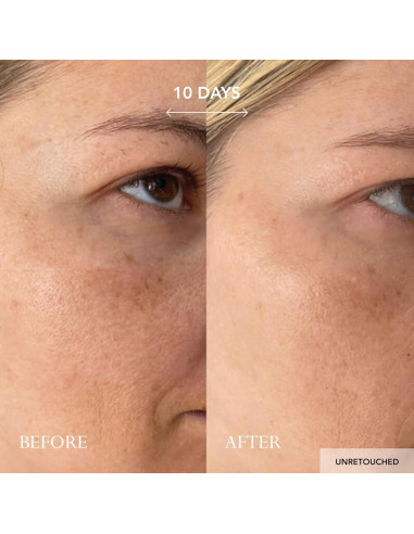 Crema Facial Intensiva Vitamina C Kat Burki 50 ml Hidratante