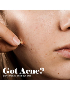 Parches para Acné BIOPURE Hydrocolloid - 24 Unidades Estrella 2