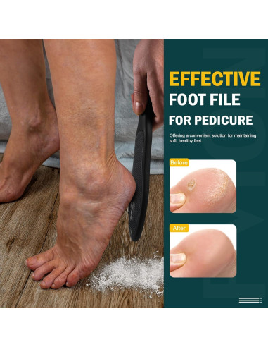 Lima de Pie de Cristal Nano FVION Doble Cara para Callos - Negro