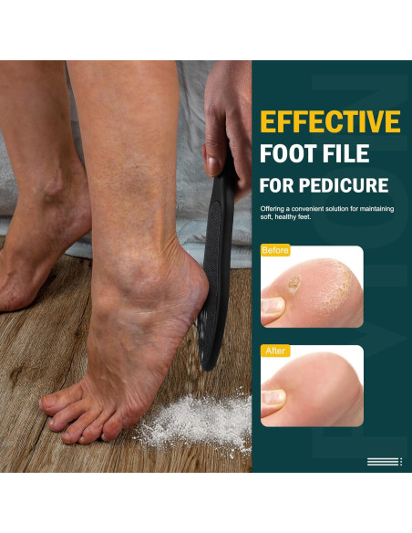 Lima de Pie de Cristal Nano FVION Doble Cara para Callos - Negro