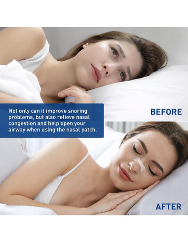 Tiras Nasales Hipoalergénicas xueyang - Alivio Congestión y Ronquidos - 44 Unidades