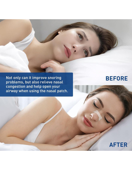 Tiras Nasales Hipoalergénicas xueyang - Alivio Congestión y Ronquidos - 44 Unidades