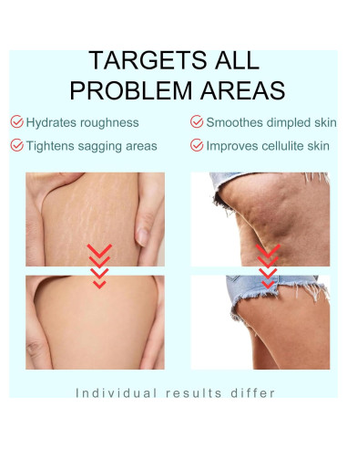 Crema Corporal Reafirmante B-TIGHT 200ml Anticelulitis