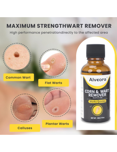 Removedor de Verrugas Líquido Alveora 17% Ácido Salicílico 91g