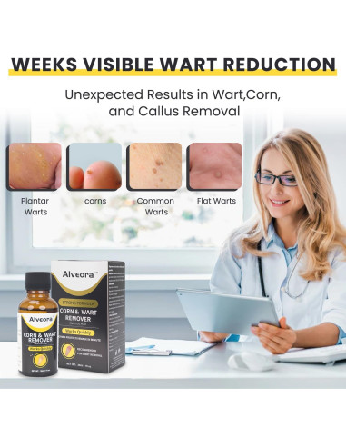 Removedor de Verrugas Líquido Alveora 17% Ácido Salicílico 91g