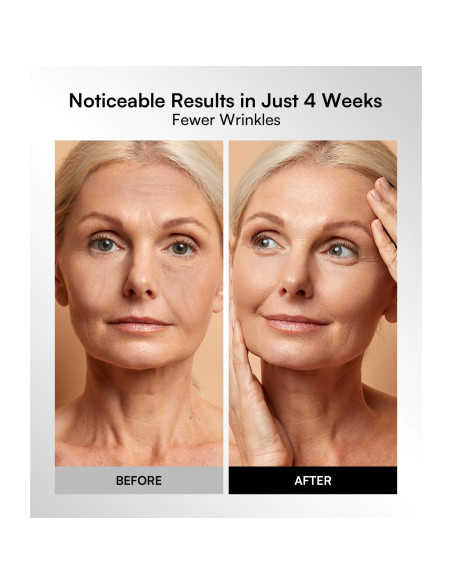 Máscara de Terapia de Luz Roja INIA - 4 Modos, LED 850nm, Recargable