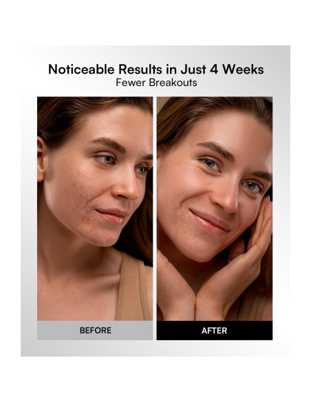 Máscara de Terapia de Luz Roja INIA - 4 Modos, LED 850nm, Recargable