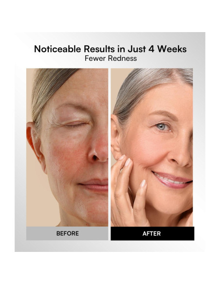 Máscara de Terapia de Luz Roja INIA - 4 Modos, LED 850nm, Recargable