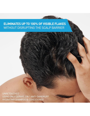 Champú y Acondicionador Hidratante Anticaspa 2 en 1 CeraVe 355 ml