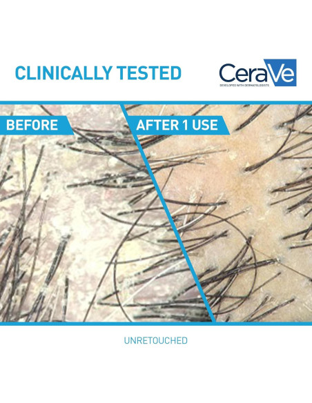 Champú y Acondicionador Hidratante Anticaspa 2 en 1 CeraVe 355 ml