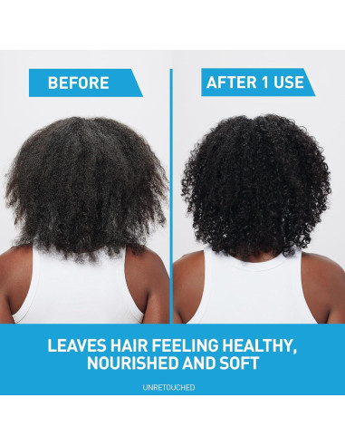 Champú y Acondicionador Hidratante Anticaspa 2 en 1 CeraVe 355 ml