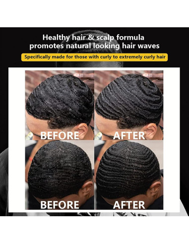 Set de Cuidado para Olas 360 Goiple - Pomada y Champú Hidratante