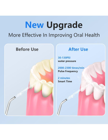 Irrigador Oral Inalámbrico NBGRLVS 320ml IPX7 6 Modos