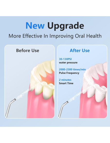 Irrigador Oral Inalámbrico NBGRLVS 320ml IPX7 6 Modos