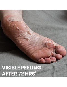 Máscara Exfoliante para Pies Coreana Chamos - Hidratante y Suave 2