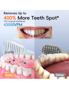 Cepillo de Dientes Eléctrico Medcodes L1-PK1-01 Rosa 42000 VPM 2