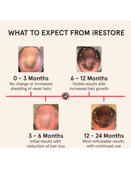 Gorro Láser iRestore Pro para Crecimiento del Cabello