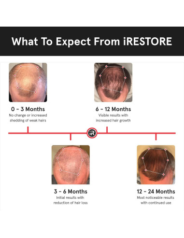 Gorro Láser iRestore - Terapia de Luz Roja para Cabello