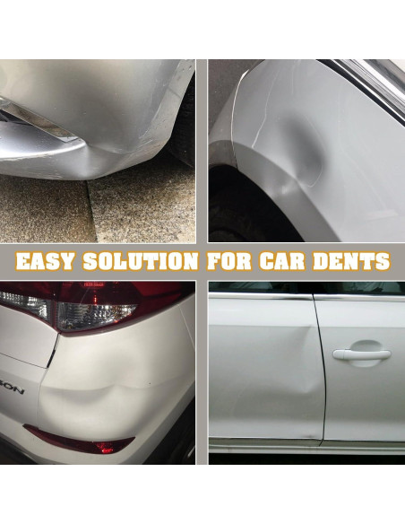 Kit de reparación de abolladuras SZLYYDS 102 piezas profesional