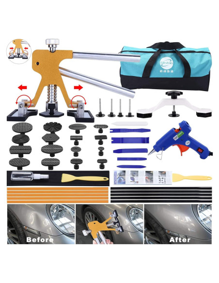 Kit de Herramientas para Reparación de Abolladuras Gliston 45 Piezas