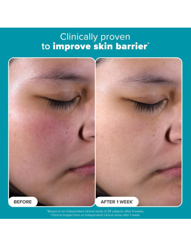 Exfoliante Facial Paula's Choice 2% BHA 113g Puntos Negros