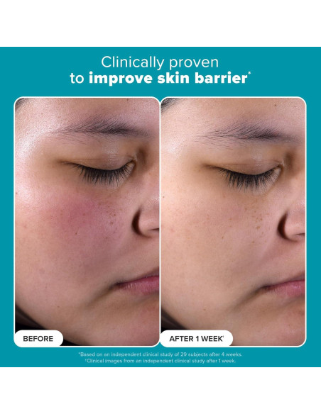 Exfoliante Facial Paula's Choice 2% BHA 113g Puntos Negros