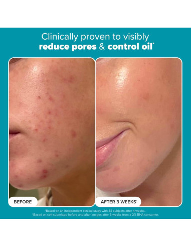 Exfoliante Facial Paula's Choice 2% BHA 113g Puntos Negros