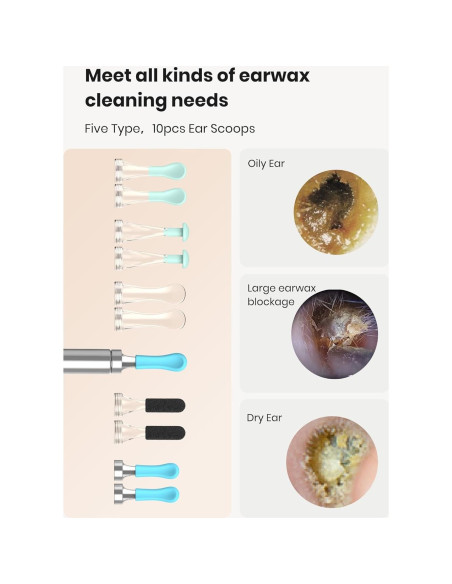 BEBIRD R1 Limpiador de Oídos con Cámara 1080P y LED