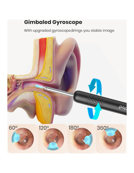 BEBIRD R1 Limpiador de Oídos con Cámara 1080P y LED