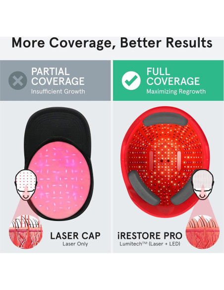 iRestore Pro Gorro Terapia Luz Roja 282 Lásers Crecimiento Cabello