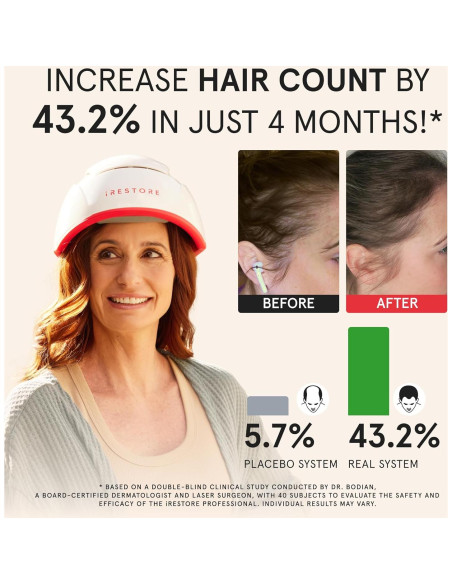 iRestore Pro Gorro Terapia Luz Roja 282 Lásers Crecimiento Cabello