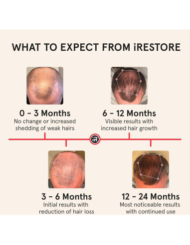 iRestore Pro Gorro Terapia Luz Roja 282 Lásers Crecimiento Cabello