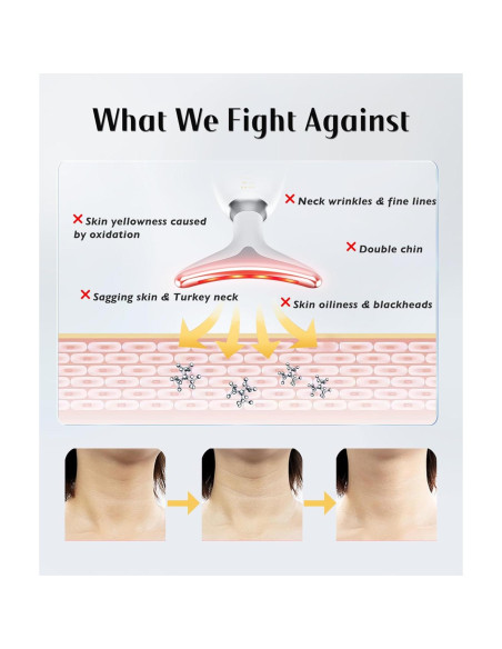 Masajeador Facial LED 7 Colores Blanco - Cuidado Piel