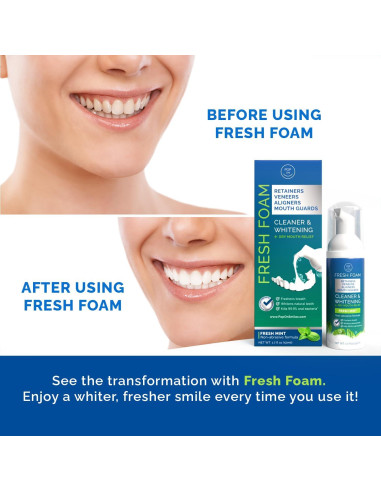 Espuma Limpiadora Pop On Fresh Foam 50ml Menta Blanqueante