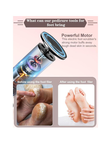 Removedor de Callos Eléctrico MOWLIE con 60 Discos de Lija