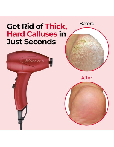 Máquina Eléctrica para Callos SaxVon FM101, 65W, 12 Accesorios