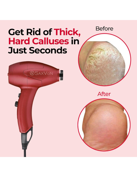 Máquina Eléctrica para Callos SaxVon FM101, 65W, 12 Accesorios